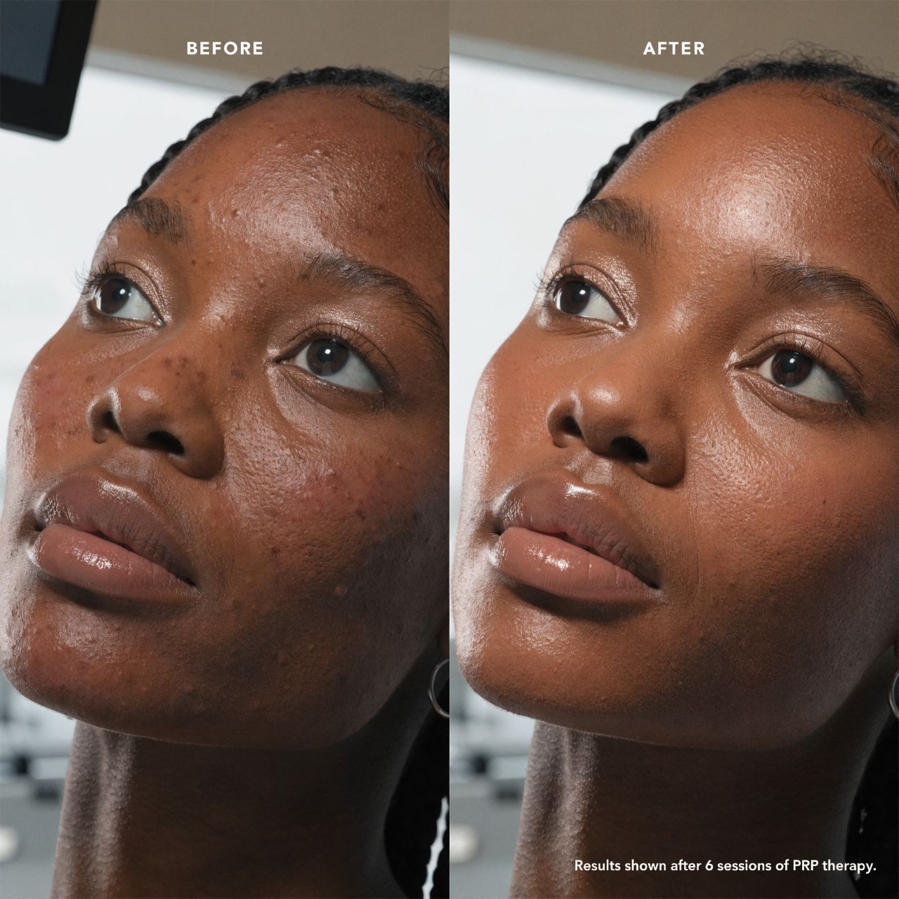 Skin Quality Reset